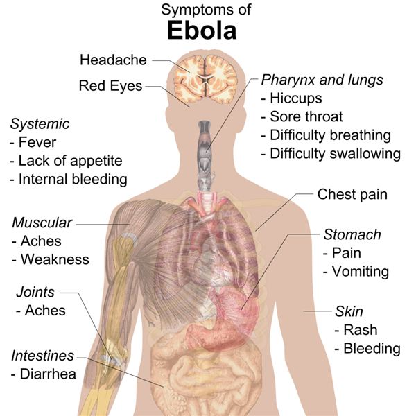 How the Ebola Virus Affects the Human Body